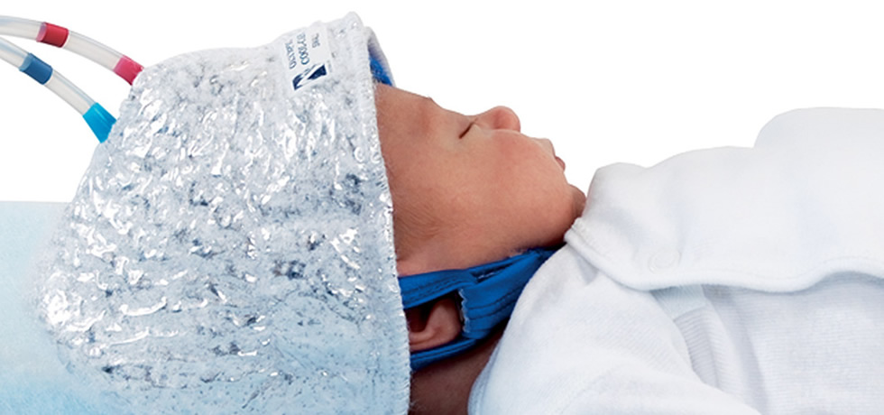 Исследование причин развития энцефалопатии новорожденных | Main causes of neonatal encephalopathy