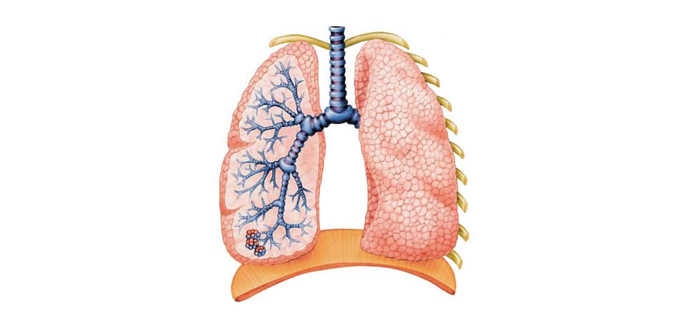Искусственное легкое | Artificial lung
