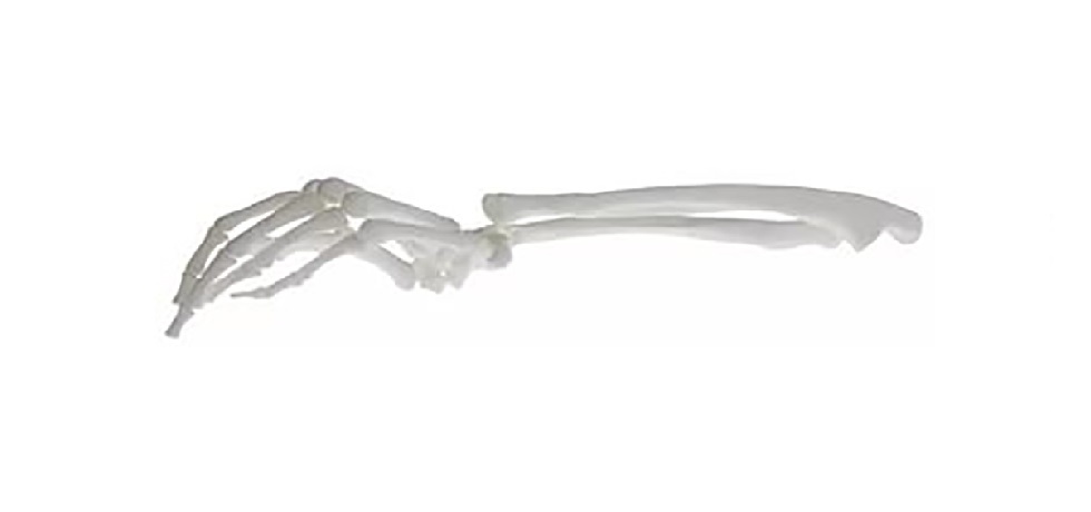 3D-printer and print of medical prostheses