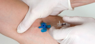 Advantages of a syringe pump